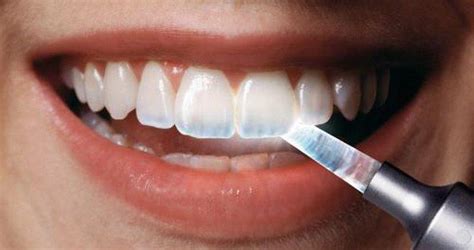 Tooth Enamel Loss Orchards Dental Blog