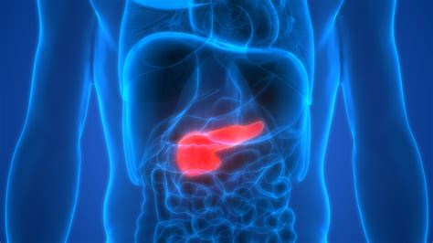 Cancer in the pancreas occurs when the cells in the pancreas multiply out of control. Symptoms of Pancreatic Cancer: The Importance of Early ...