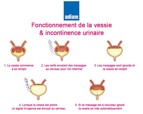 Incontinence Urinaire Traitement Symptome Et Aide Domicile Paris