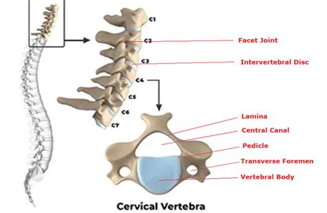 Cervical Spine Surgery Bridgewater Ma Cervical Spine Treatments