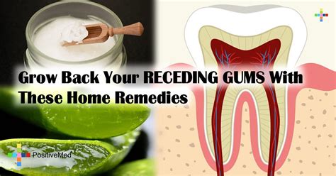 Grow Back Your Receding Gums With These Home Remedies Receding Gums