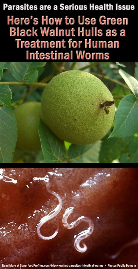 How To Use Black Walnut Hull As A Parasite And Intestinal Worm Cleanse