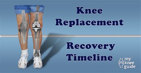 Severe Pain After Knee Replacement Surgery