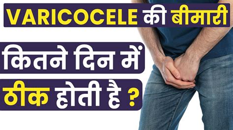 Varicocele की बीमारी कितने दिन में ठीक होती हैvaricocele Natural Treatment In Hindi Youtube