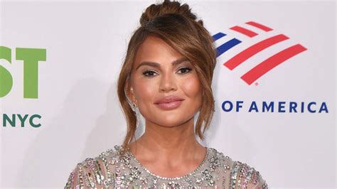 Chrissy Teigen Reveals She Has To Bandage Together Her Wound While