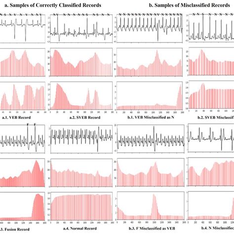 Ecg Classification With A Convolutional Recurrent Neural Network Deepai