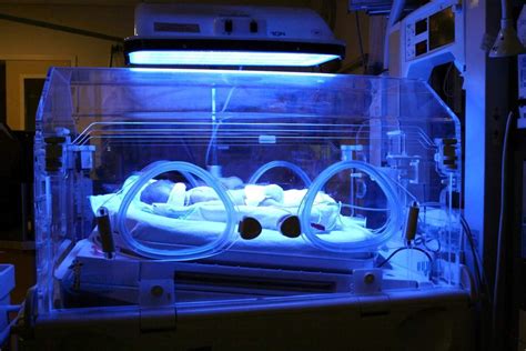 Infant Under Phototherapy Incubator Theayurveda