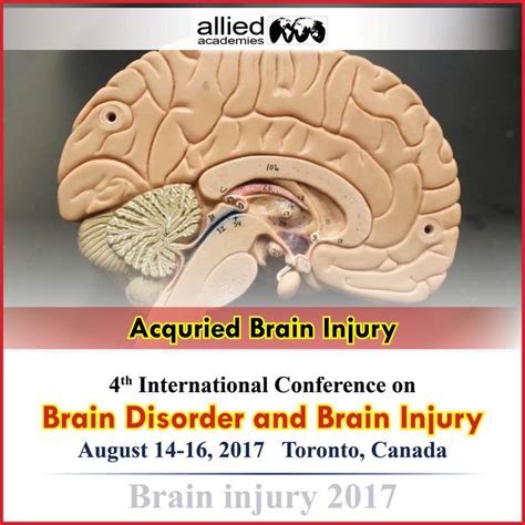Acquired Brain Injury Acquired Brain Injury Abi Refers To Any Type Of