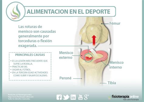 Cid Ruptura De Menisco