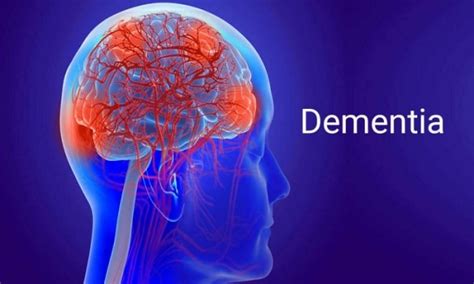 Dementia Stages And Symptoms Briefly Explained Health Blog