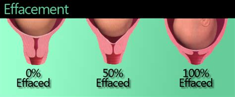 In mathematics, a percentage (from latin per centum by a hundred) is a number or ratio expressed as a fraction of 100. Heart's on the Outside: Centimeters and Dilation
