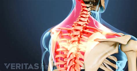 Common Causes Of Back Pain And Neck Pain