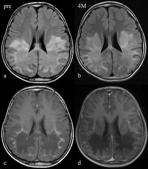 Magnetic Resonance Imaging Mri Data A Initial Cerebral Mri Cmri