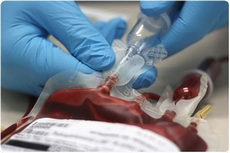 Hiv And Blood Transfusions