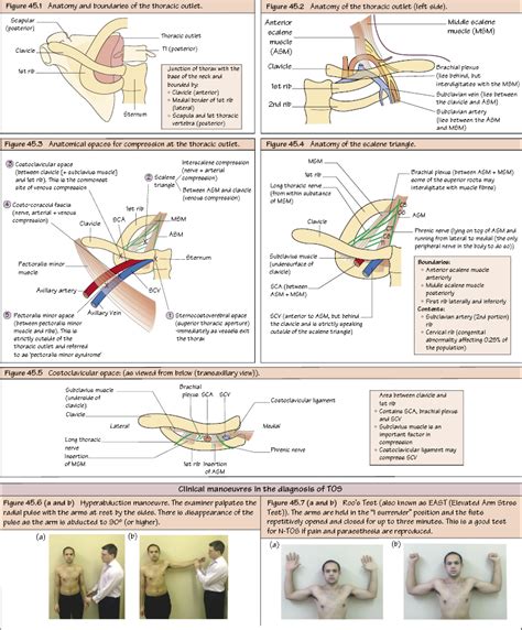 Thoracic Outlet Syndrome Anatomy