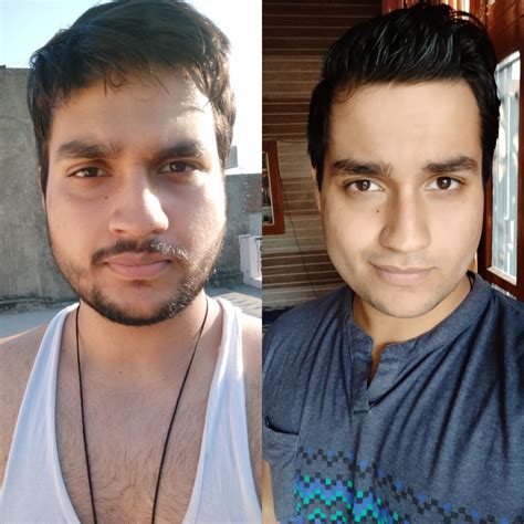Keep an eye on the amount of carbs and sugar you take. Face fat is hard to get rid of, Here's my one week transformation of face. I lost fat from the ...