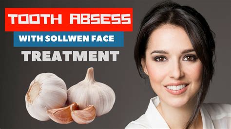 Abscess Tooth Swollen Face Pictures Picturemeta