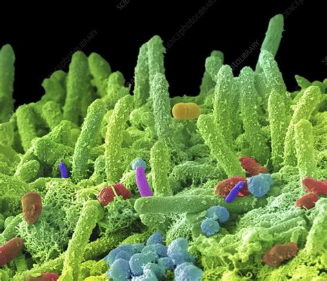 What Do Germs And Bacteria Look Like Under A Microscope Facts And Tips