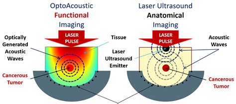 Advanced Laser Ultrasound Imaging For Image Guided Surgery