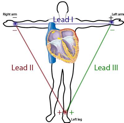 Cardiovascular Lab: Electrocardiogram: Setup