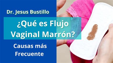 Porque Me Baja Flujo MarrÓn Despues De Mi Menstruacion O Después De Las