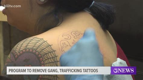 Volunteer Group Receives Funding To Remove Gang Trafficking Tattoos On Juveniles