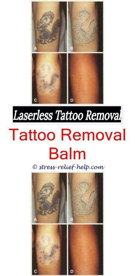 Log in to your tumblr account to start posting to your blog. How much laser tattoo removal in philippines.Laser tattoo ...