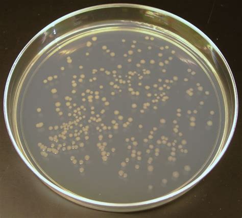 Li On Nutrient Agar Agar Plates Microorganisms