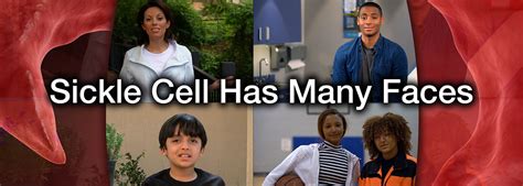 Learn More About Sickle Cell Disease Cdc