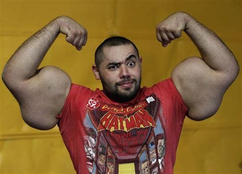 5 Things You Need To Know Before Using Synthol