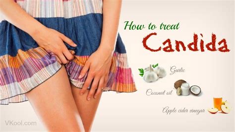 How To Treat Candida Naturally At Home Best Tips Ever