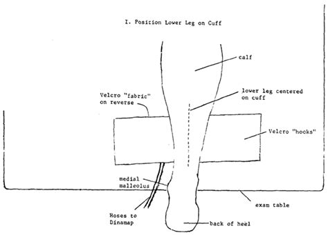 Placement Of The Blood Pressure Cuff On The Ankle Step Ipositioning