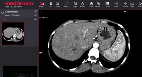 Microdicom is a free dicom viewer. 5 Free Online Dicom Viewer Websites to Open and View DCM Files