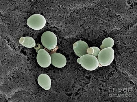 Candida Albicans Yeast Cells Photograph By Jannicke Wiik Nielsen
