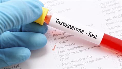 Does Your Testosterone Level Put You At Risk For Prostate Cancer Texas A M Today
