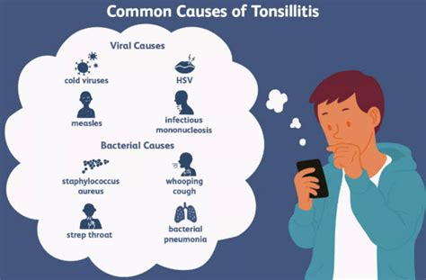 Tonsillitis Getcured Apothecary Pvt Ltd