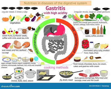Infographics Proper Nutrition Gastritis Stock Vector Illustration Of