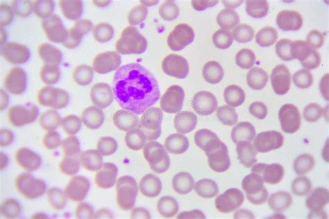 Neutrophil Cell Stock Image Image Of Research Abnormal 92593959