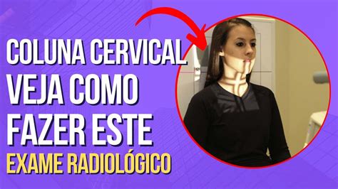 Posicionamento Radiológico Da Coluna Cervical Youtube