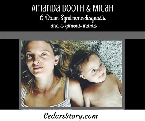 Celebrities And Down Syndrome Interview With Amanda Booth Cedars Story