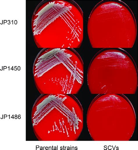 Colony Morphology Of Three Rifampicin Resistant S Aureus Strains And