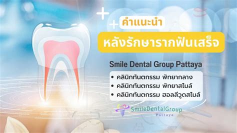 การรักษารากฟัน พร้อมคำแนะนำหลังรักษาเสร็จ Smile Dental Group Pattaya