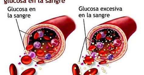 Ayúdate Remedios Naturales Para Controlar La Glucosa En Sangre