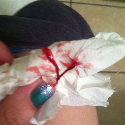 I Been Bleeding For 6 Days I Keep Having Stringy Like Blood Clots And