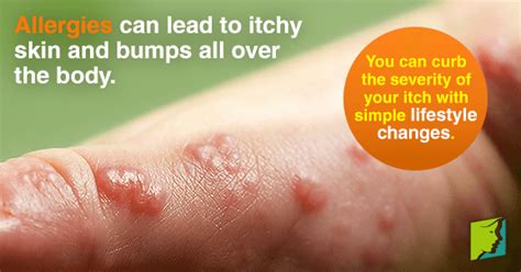 Can Eggs Cause Itchy Skin The Horrific Damage Baby Wipes Can Do To