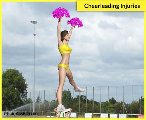 Cheerleading Injuries Statistics Common Injuries Prevention Tips