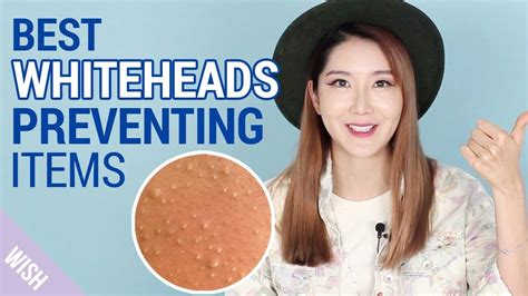 What Causes Whiteheads How To Prevent Whiteheads With Images