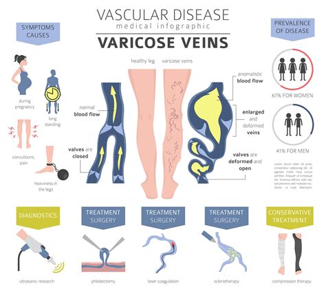 Varicose Veins Wilton Ct And Fairfield Ct Center For Varicose Veins