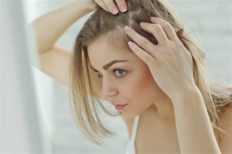 Femmes Et Perte De Cheveux Les 10 Meilleurs Remèdes Et Traitements