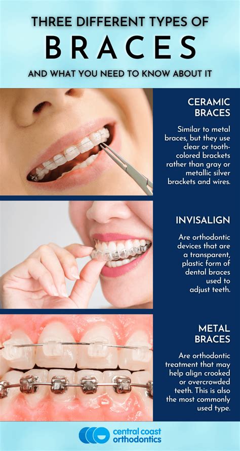Three Different Types Of Braces Central Coast Orthodontics